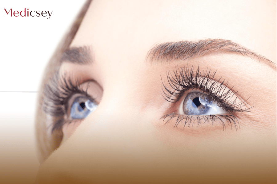 Lens Replacement Surgery in Turkey Medicsey